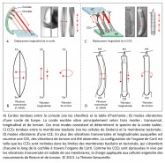 Cordes tendues, console, harpe, chevilles, analogie, analogie sensorielle, table d'harmonie, nomdes vibratoires, corde de harpe, CCEs, cellules ciliées externes, vibration, modes, transversal, longitudinal, torsion, cellules de Deiters, membrane tectoriale, organe de Corti, cochlée, radiale, flexion, mouvements, oreille, biomécanique, biologie