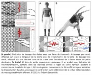 tassage des duites, lame, tisserand, trame, tranchant, serré, denticules, libération de neurotransmetteur, vésicules, calice nerveux, contraction, cellule de type I, mouvements, fibre efférente, dépolarisation, relachement, modulation, message vestibulaire afférent